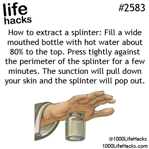 How to Extract a Splinter – Do It And How