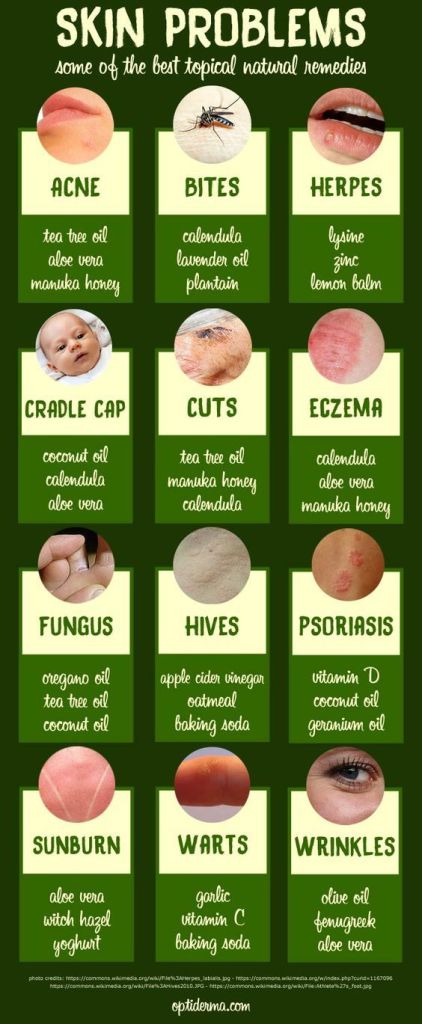 Skin Problem Topical Guide – Do It And How
